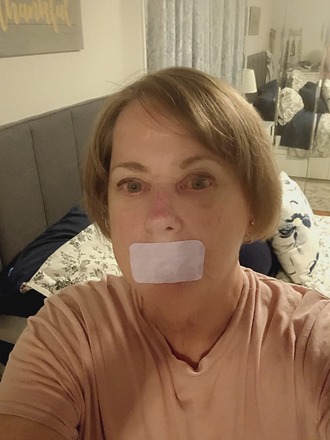 Customer photo review of ZzzTape - Mouth Tape