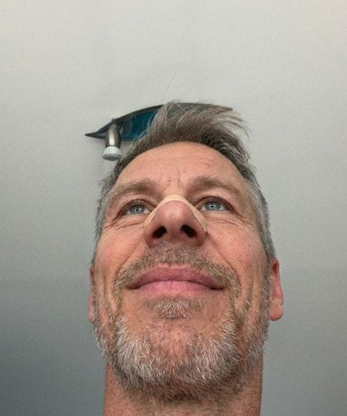 Customer photo review of nordicalm™ Nasal Strips for Sleep