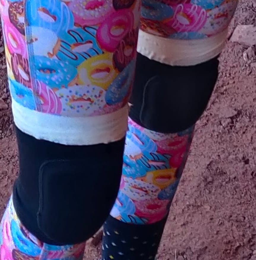 Customer photo review of EuroTape White 1.5" x 12.5yd (Climbing Tape)
