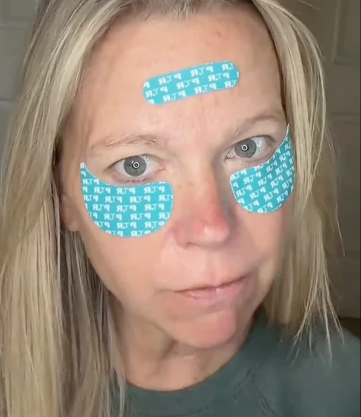 Customer photo review of Patch Skinjection aux peptides — Visage & Contour des yeux