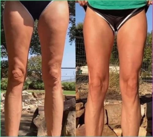 Customer photo review of Legging anti-cellulite Sleemz™
