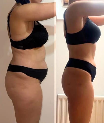 Customer photo review of Legging anti-cellulite Sleemz™
