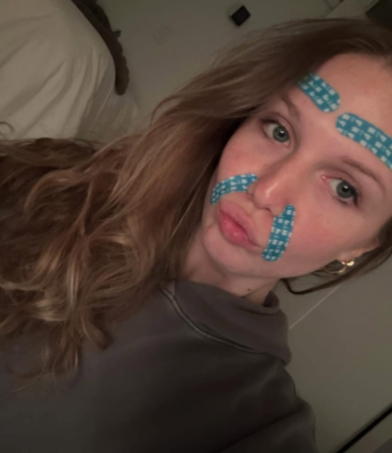 Customer photo review of Patch Skinjection aux peptides — Visage & Contour des yeux