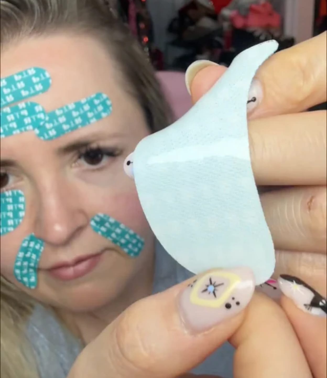 Customer photo review of Patch Skinjection aux peptides — Visage & Contour des yeux
