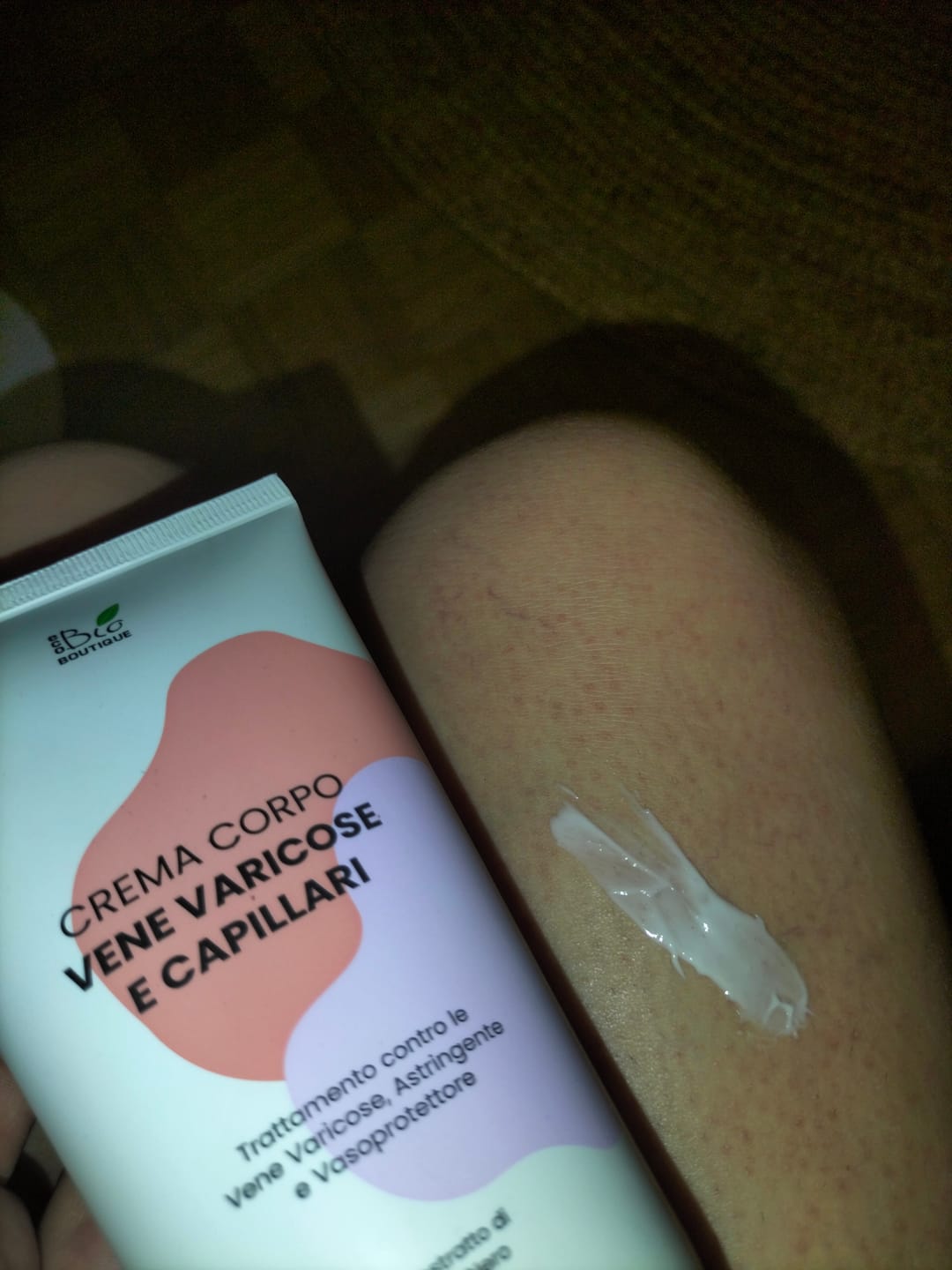 Customer photo review of Crema Vene Varicose e Capillari