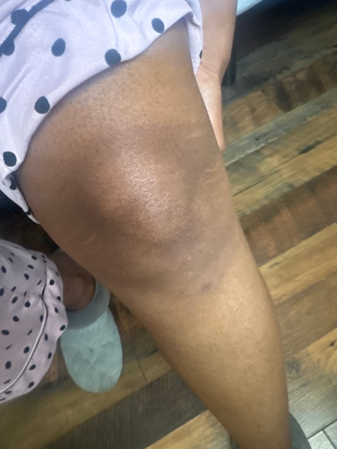 Customer photo review of Melanin Skin Bundle