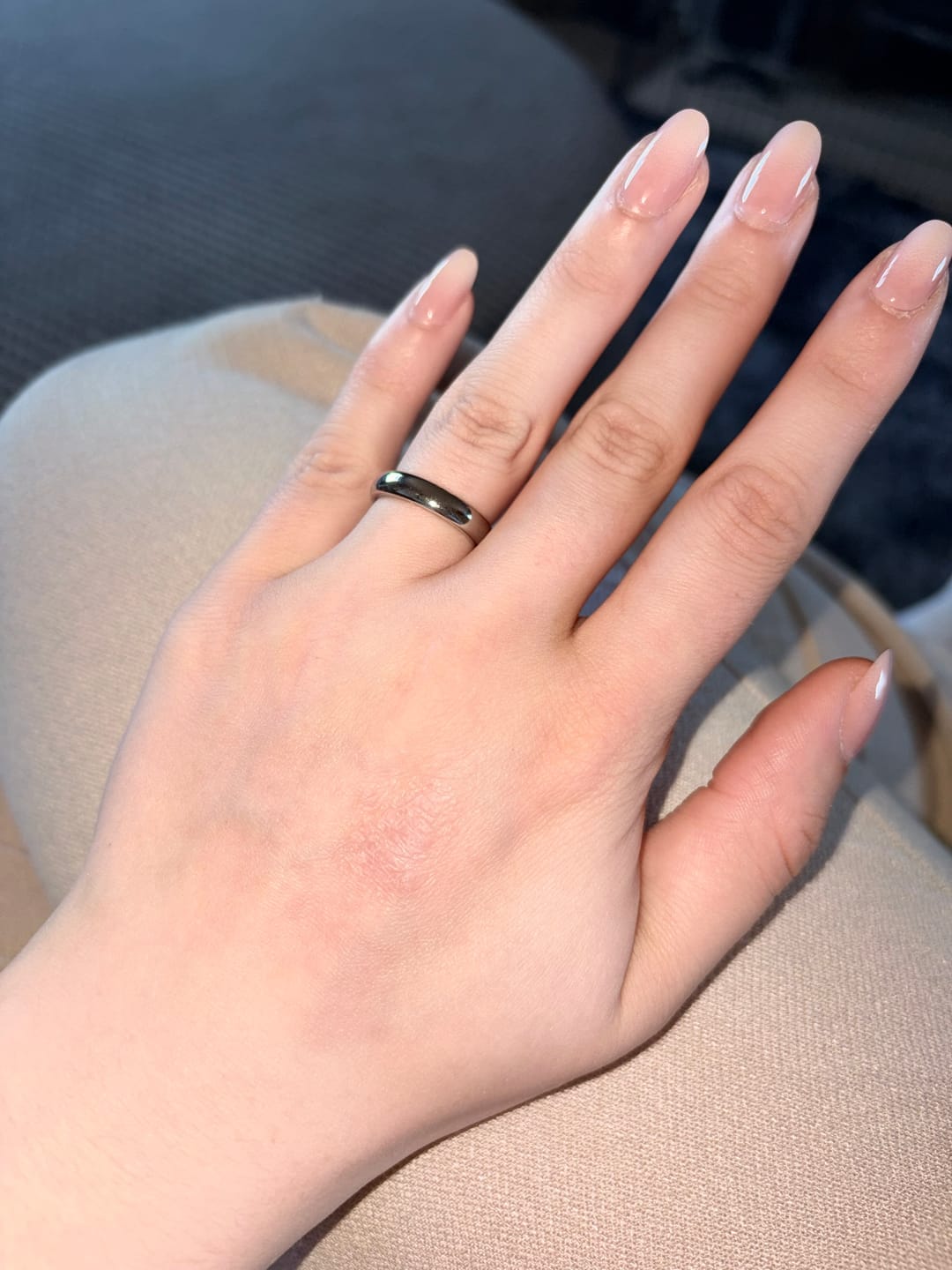 Customer photo review of Herbal Psoriasis Relief Cream