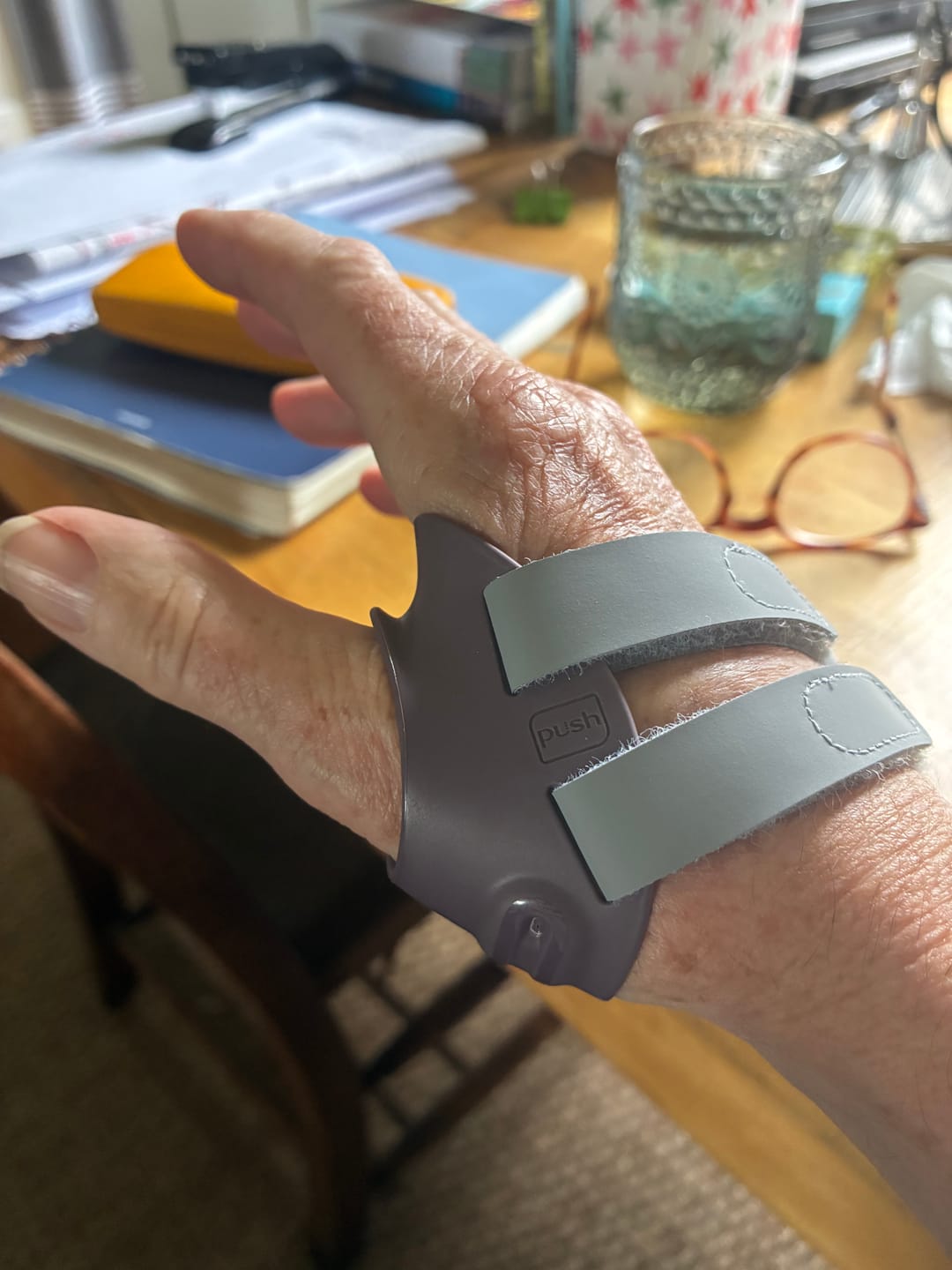 Customer photo review of Push Ortho CMC Thumb Brace – Osteoarthritis Support Splint for Thumb Joint Stabilisation