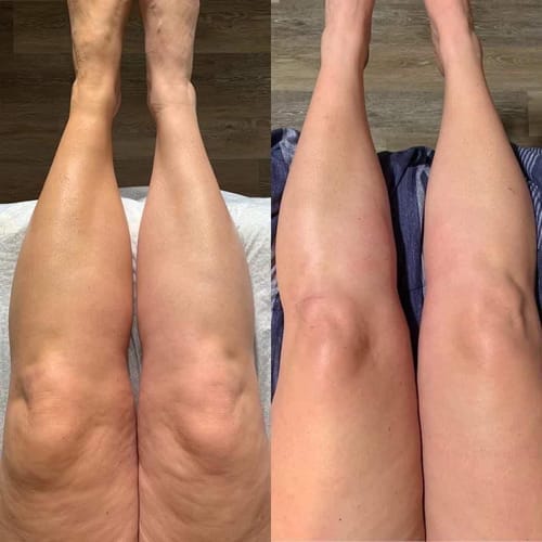Customer photo review of Legging anti-cellulite Sleemz™