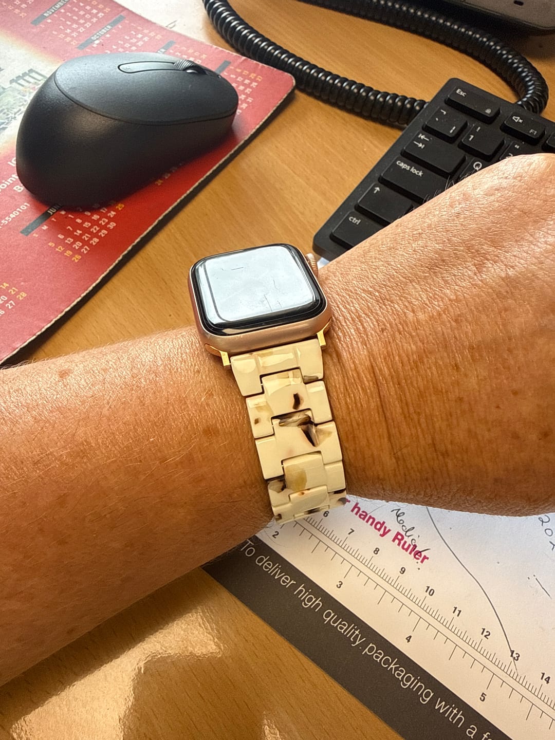 Customer photo review of Perla Ceramic Strap