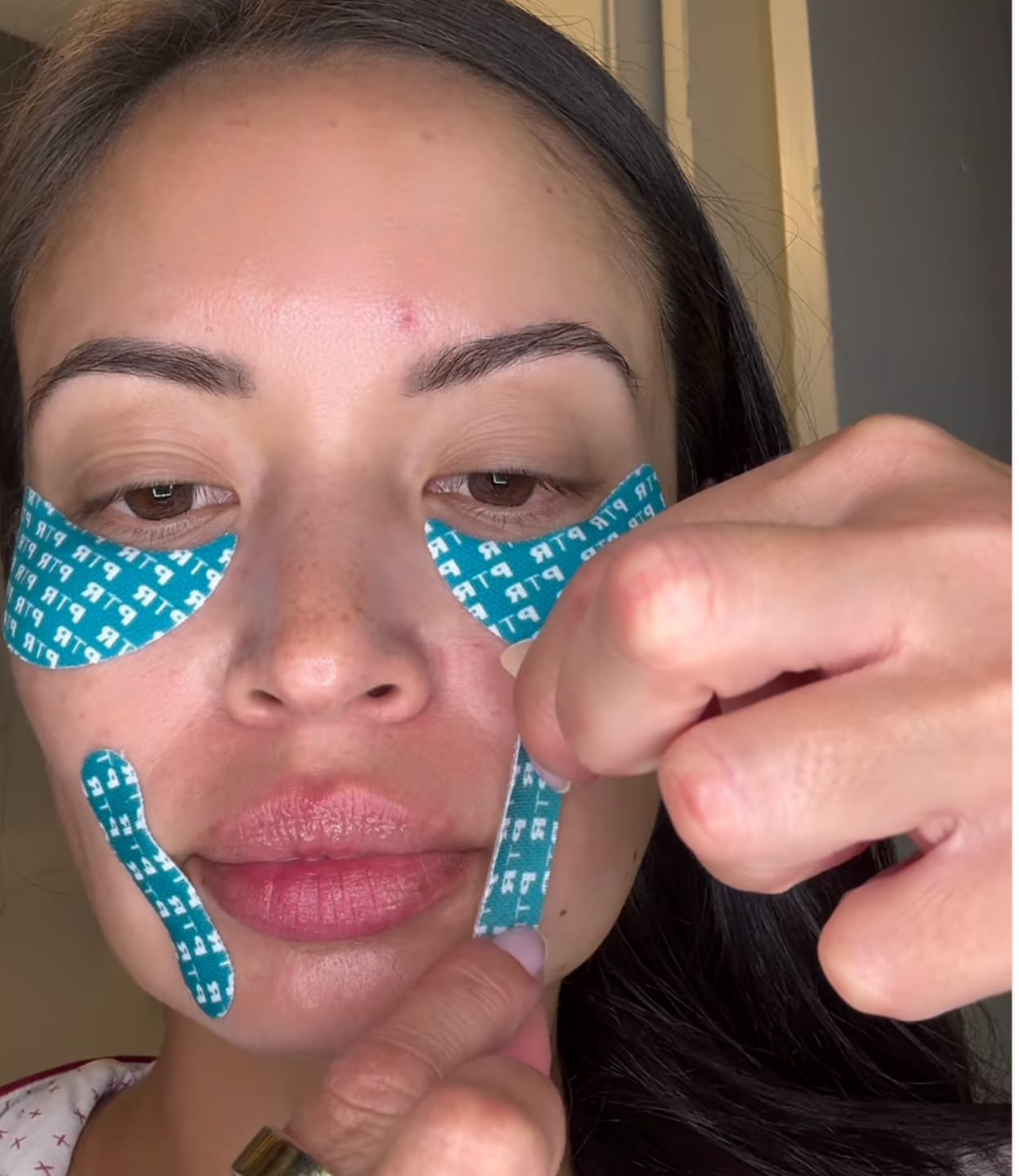 Customer photo review of Patch Skinjection aux peptides — Visage & Contour des yeux