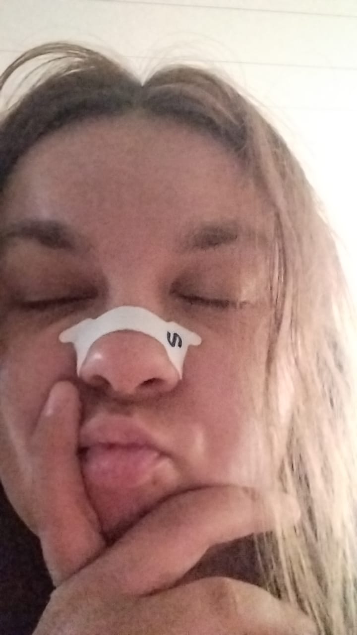 Customer photo review of Nuku Sleep Nasal Strips