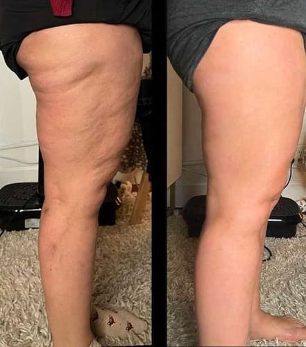Customer photo review of Legging anti-cellulite Sleemz™
