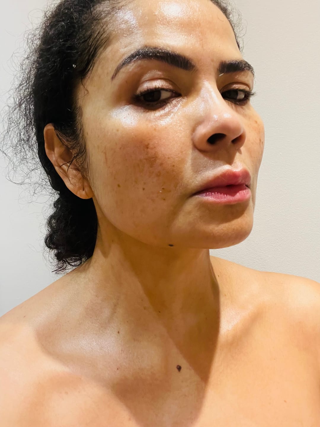 Customer photo review of Calm Skin-Relief Kit