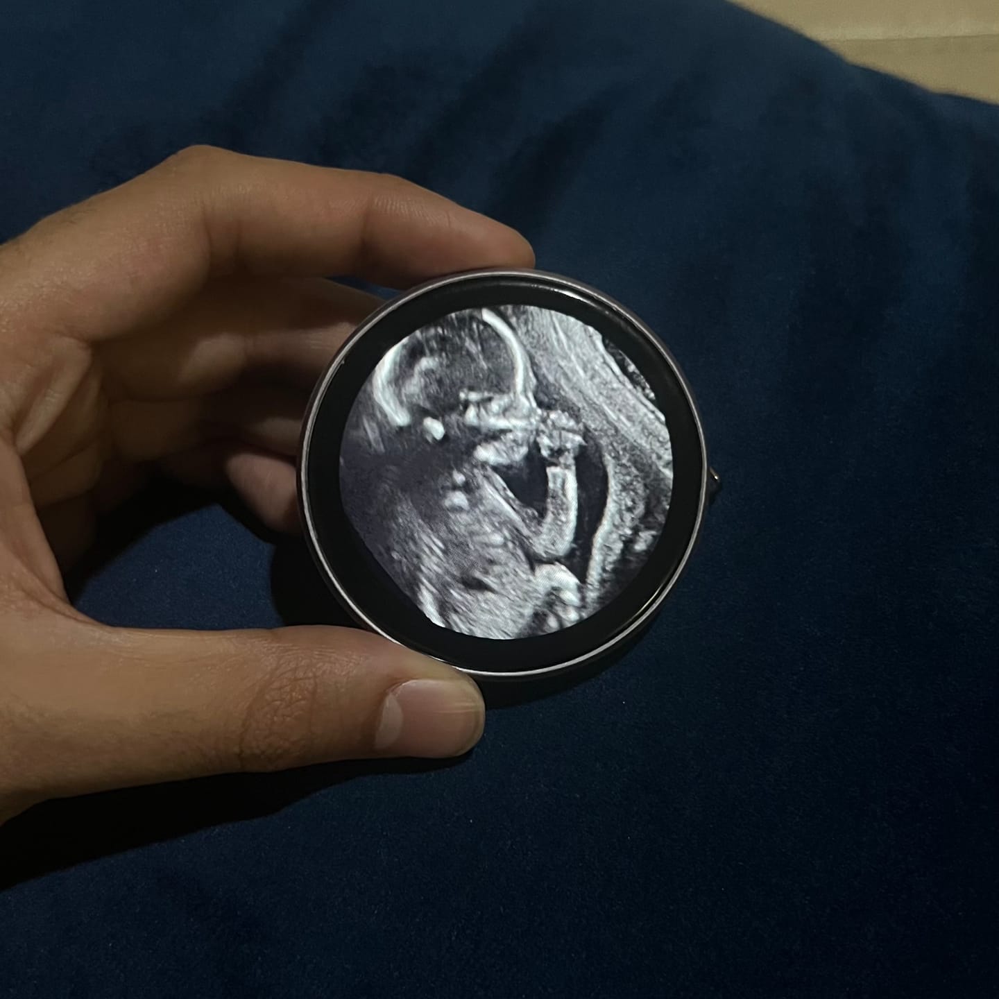 Customer photo review of LoveLoop™ — El primer recuerdo de tu bebé