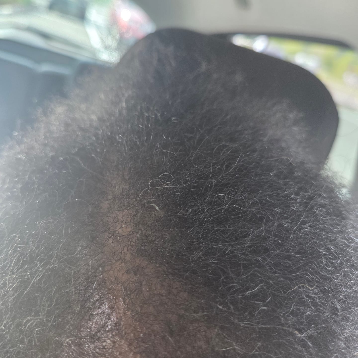 Customer photo review of Ultimate Hair Growth Bundle