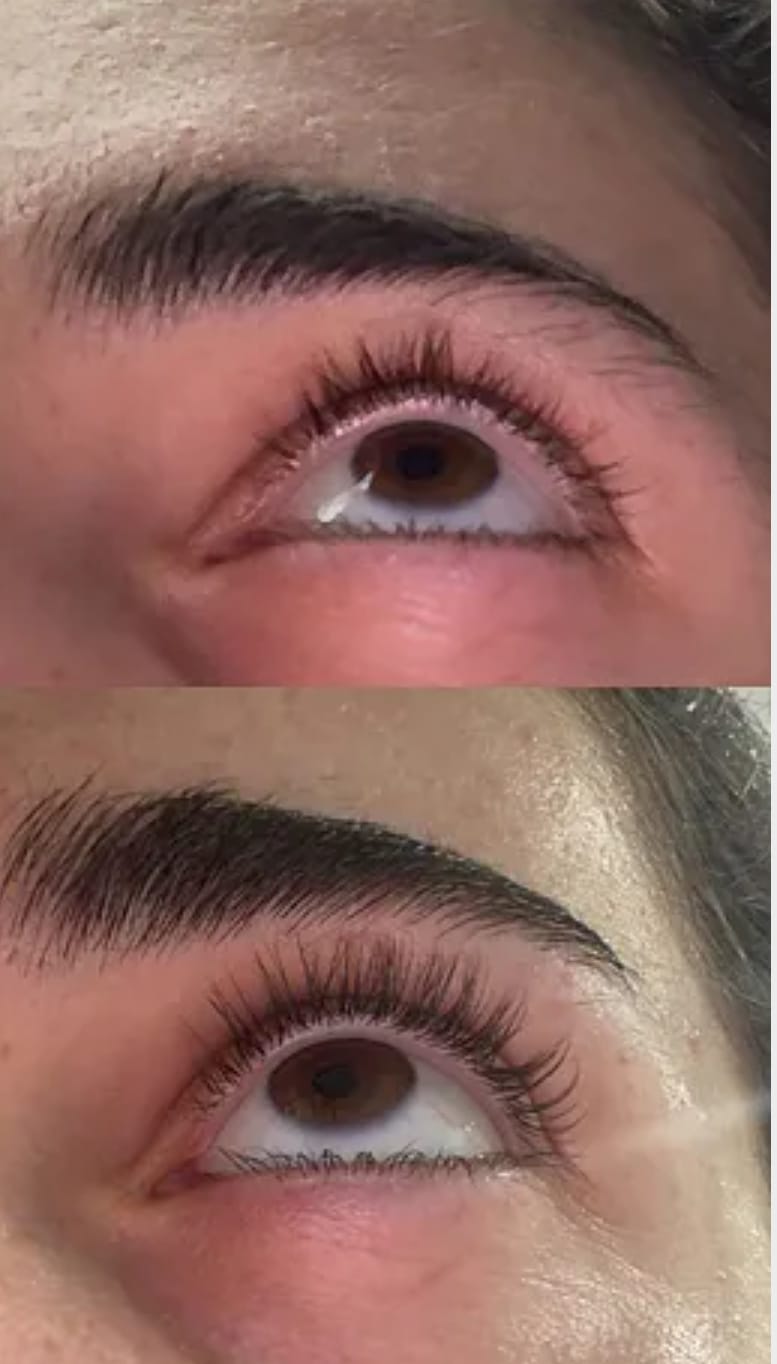 Customer photo review of סרום לשיקום וצמיחת הריסים של NOVELA