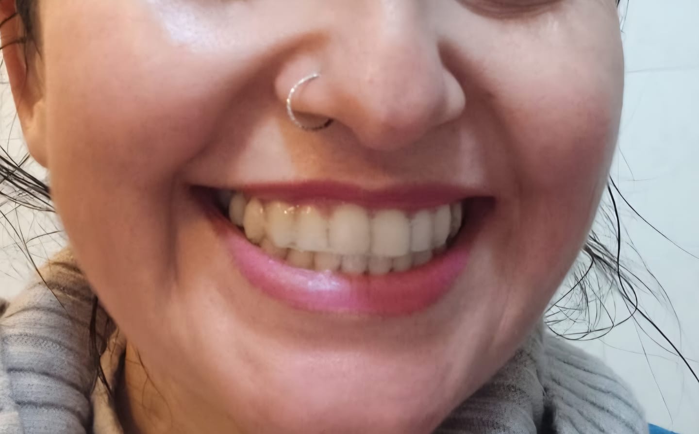 Customer photo review of Pasta Dental