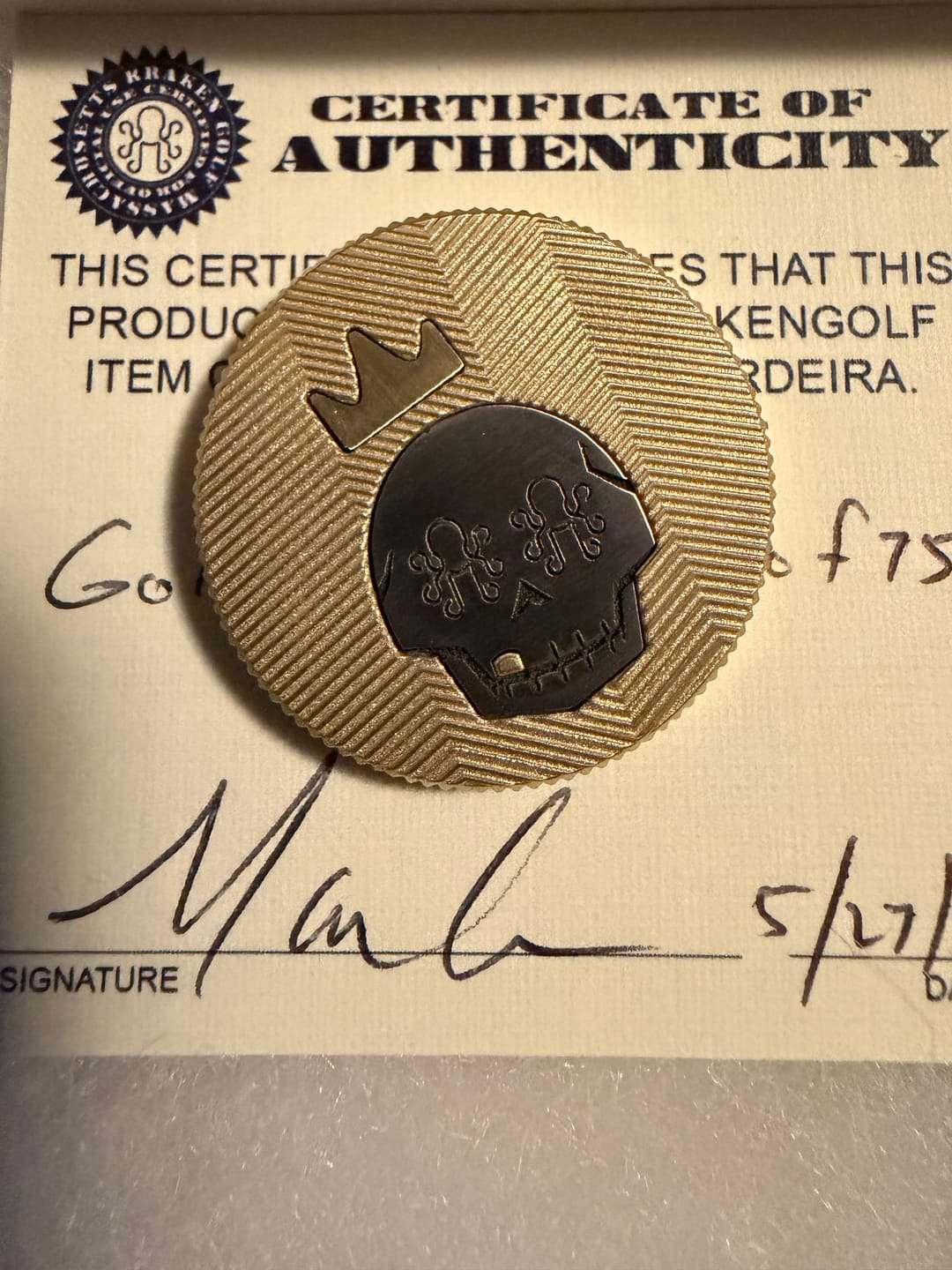Customer photo review of 💀👑 The Gold Tooth