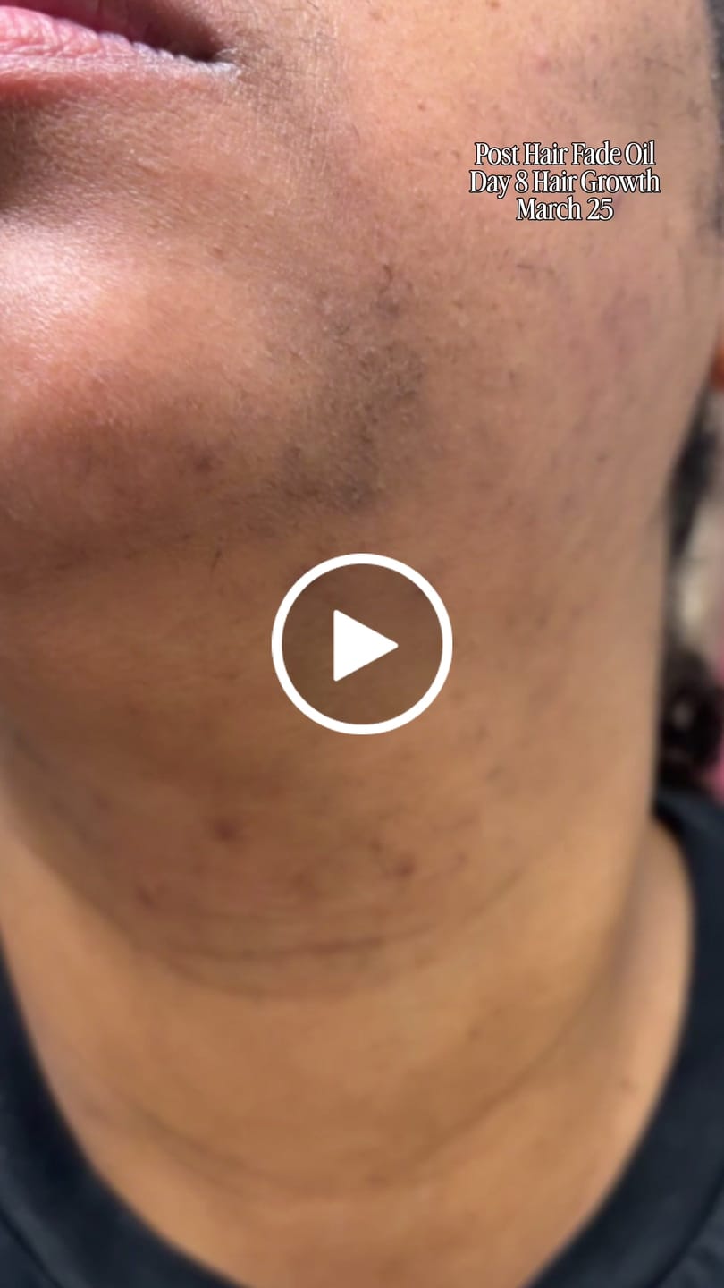Customer video review of Hair Reducing Fade Oil - Slows Growth, Thins, and Reduces Hair Naturally