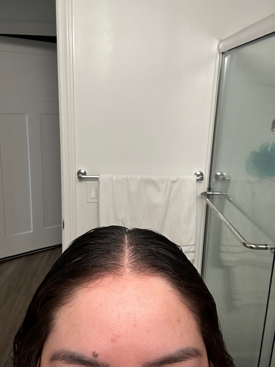 Customer photo review of VITAFOAM ™ Hair Growth Formula