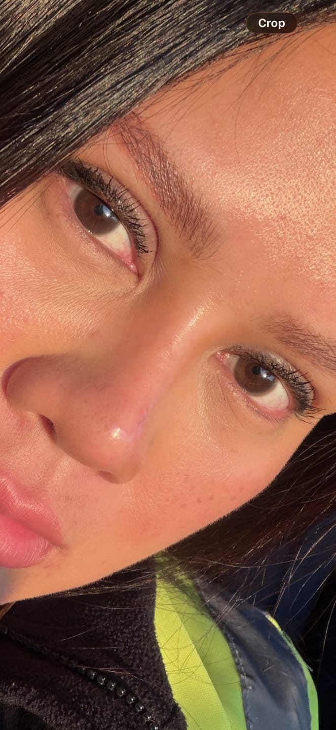 Customer photo review of Olens ViVi Ring 1 Day Choco Lenses
