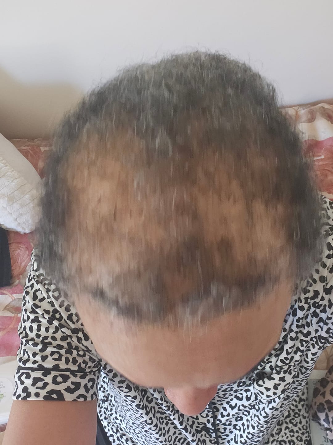 Customer photo review of Rennora Hair Growth Serum