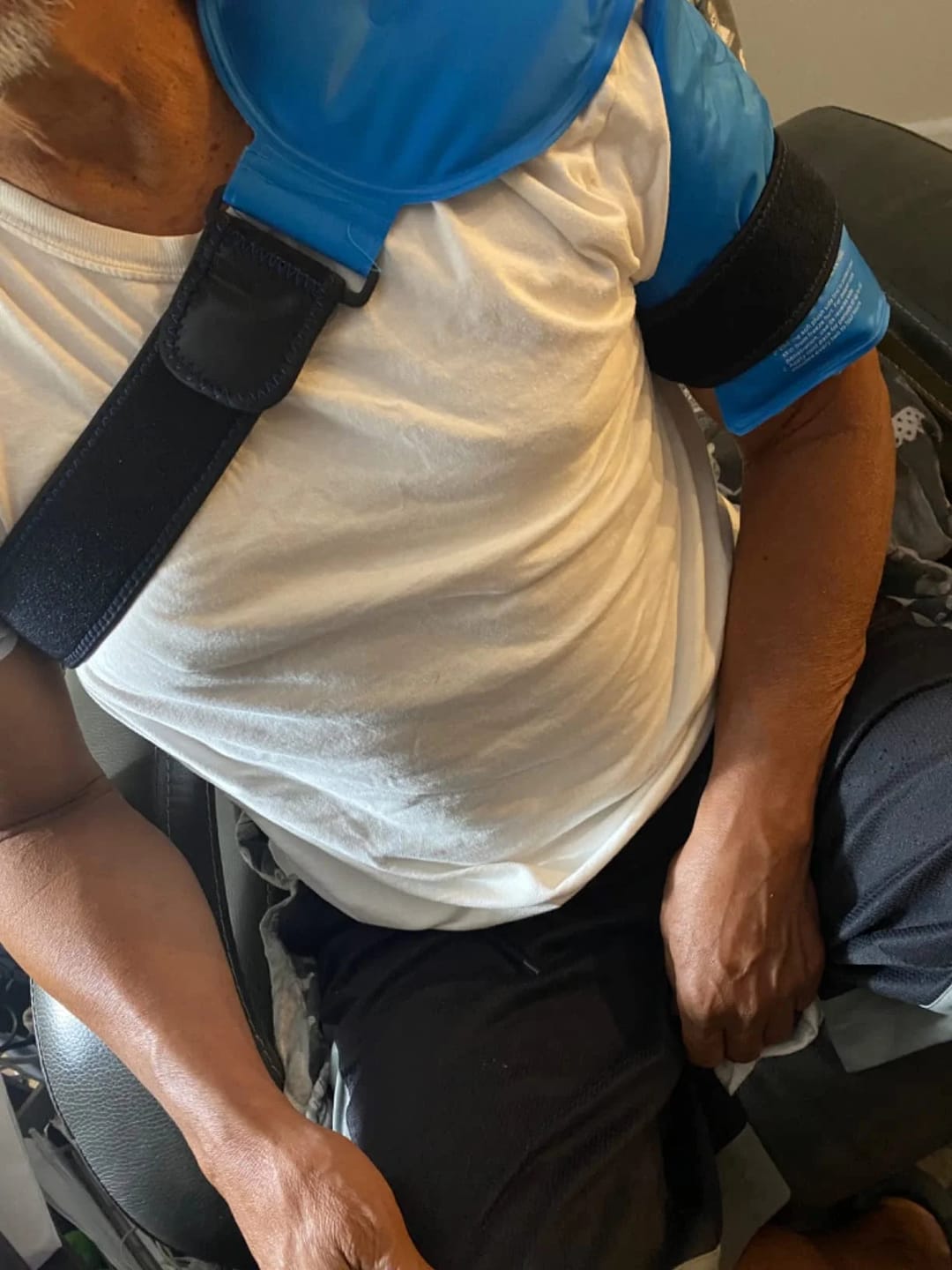 Customer photo review of Shoulder Ice Pack Support Brace