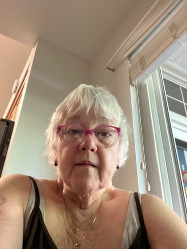 Reviewer's close-up selfie showing their face and neck after using Koriderm™ Time Reverse.