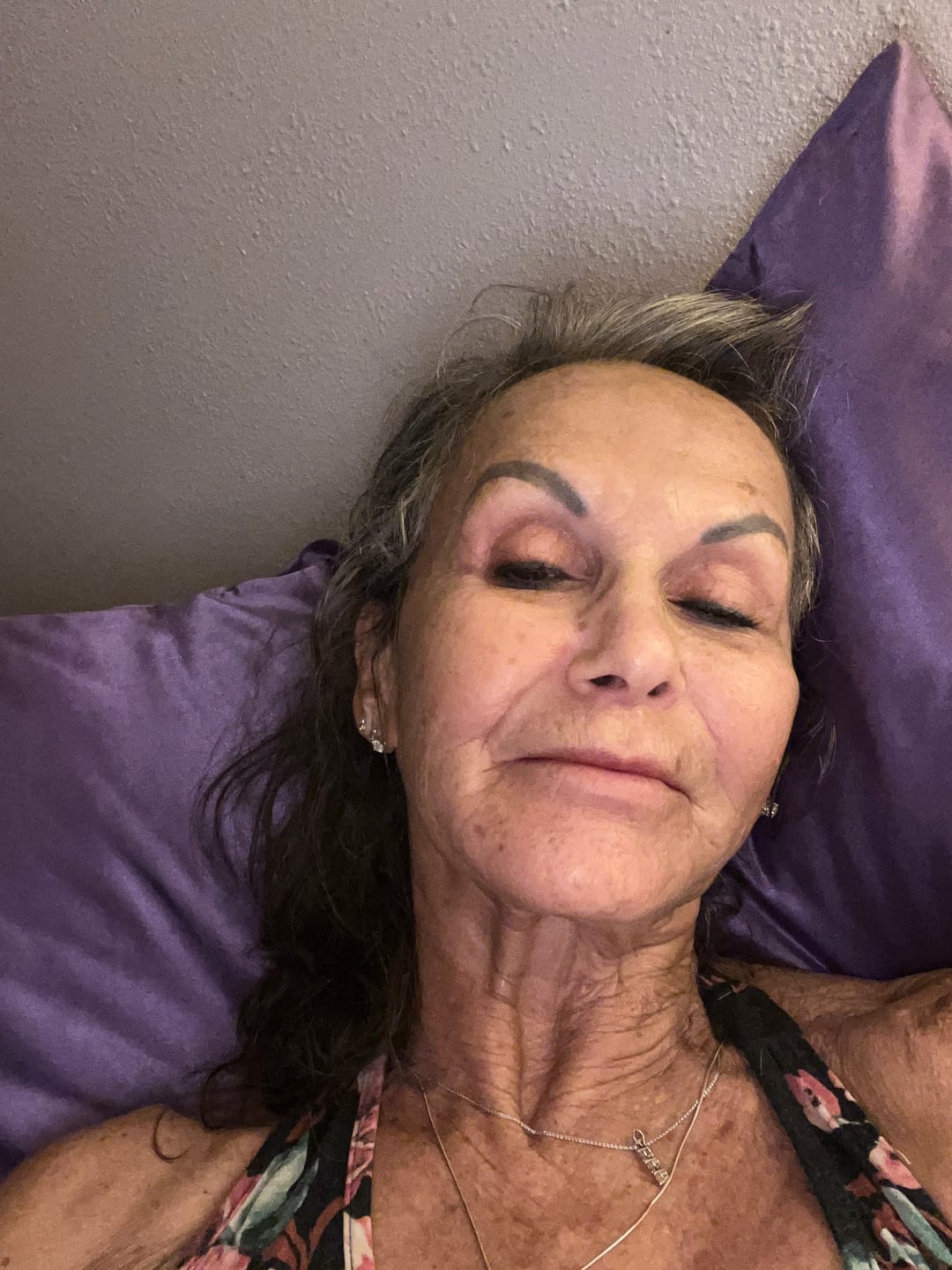 Customer photo review of Koriderm™ Time Reverse (All-In-One) *