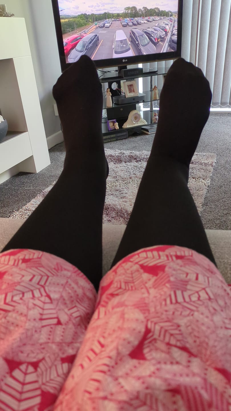 Customer photo review of The Step by Step Guide To Transforming Your Leg Health