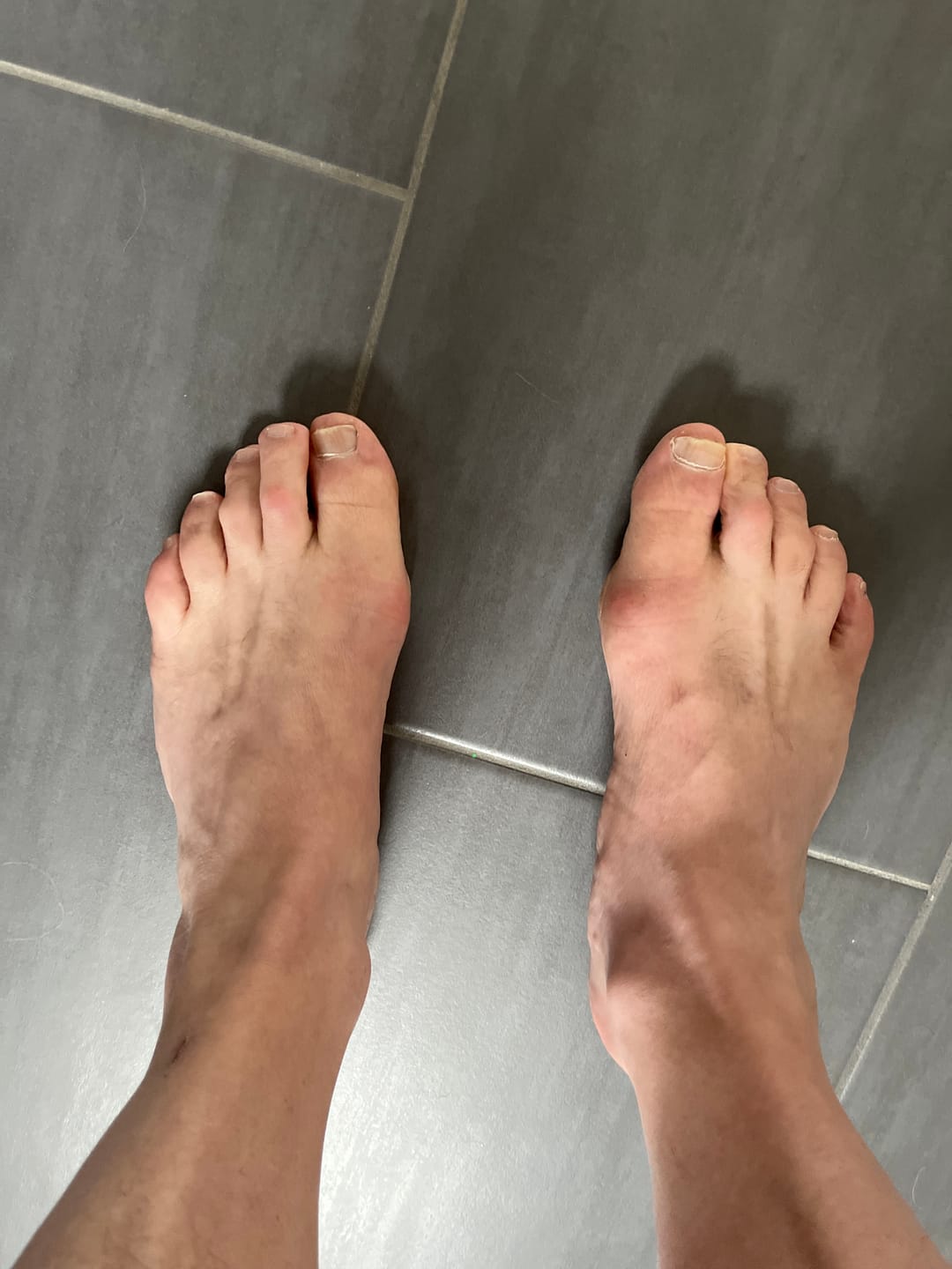 Customer photo review of Trek-Barfussschuh