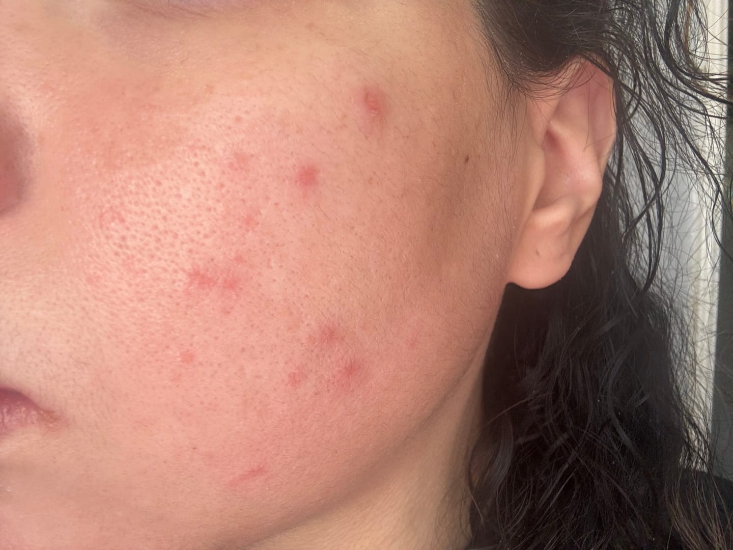 Customer photo review of Glutathione kojic acid eye patch Vita jelly