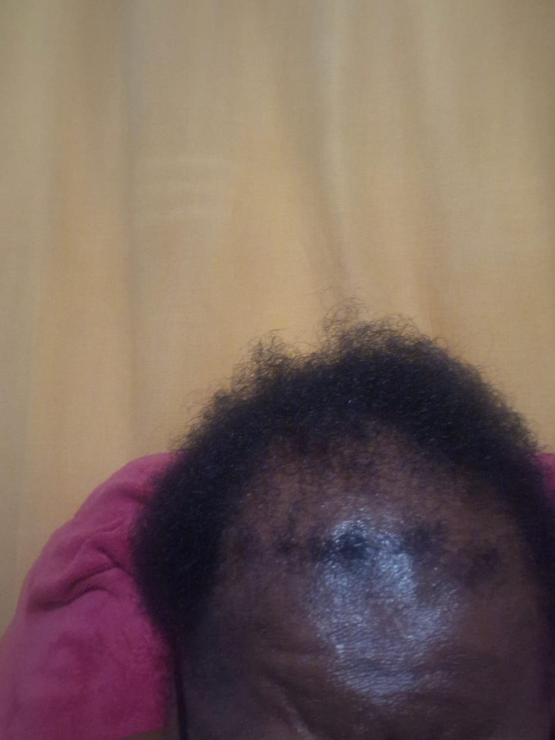 Customer photo review of Ultimate Hair Growth Bundle