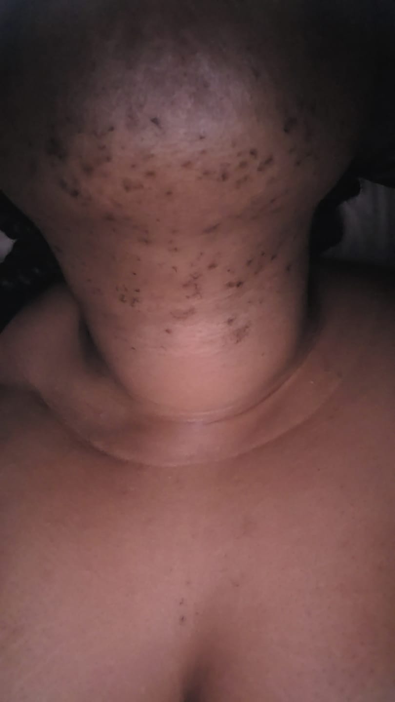 Customer photo review of Hair Reducing Fade Oil - Slows Growth, Thins, and Reduces Hair Naturally