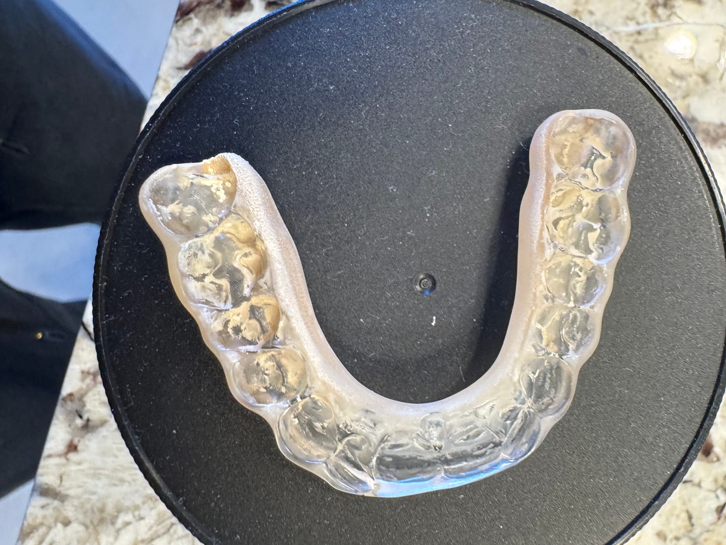 Customer photo review of Dental Pod Pro + 90 free Tablets