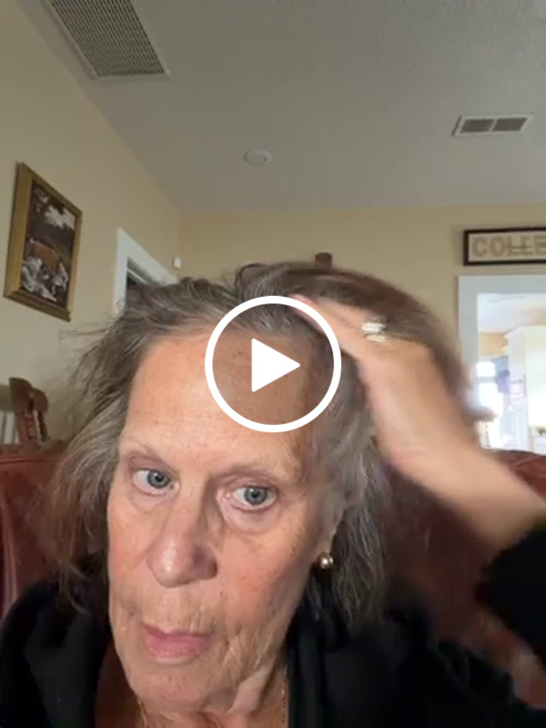Customer video review of Sterile Needle Heads