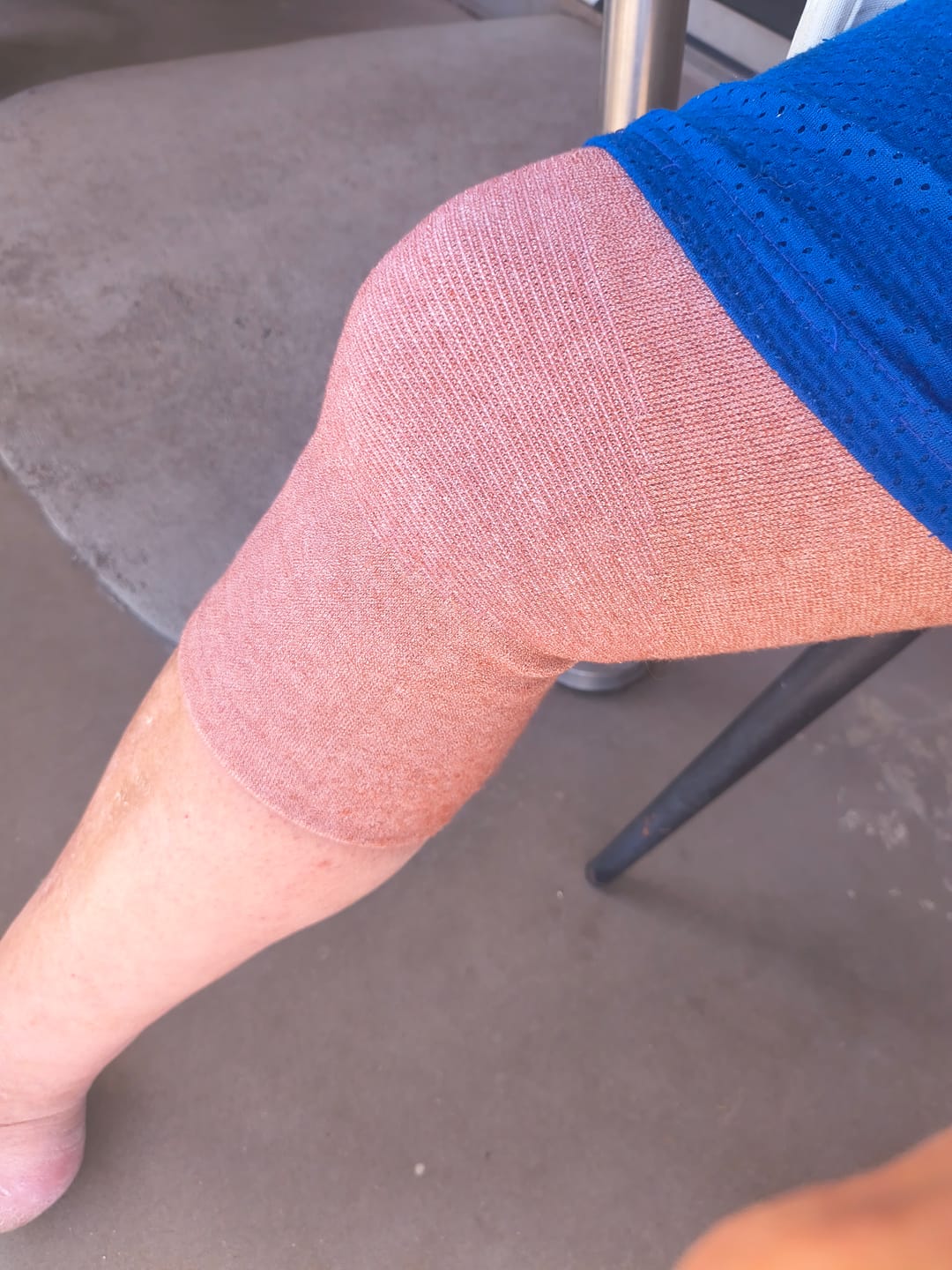 Customer photo review of Premium Bamboo Knee Sleeve (Single)
