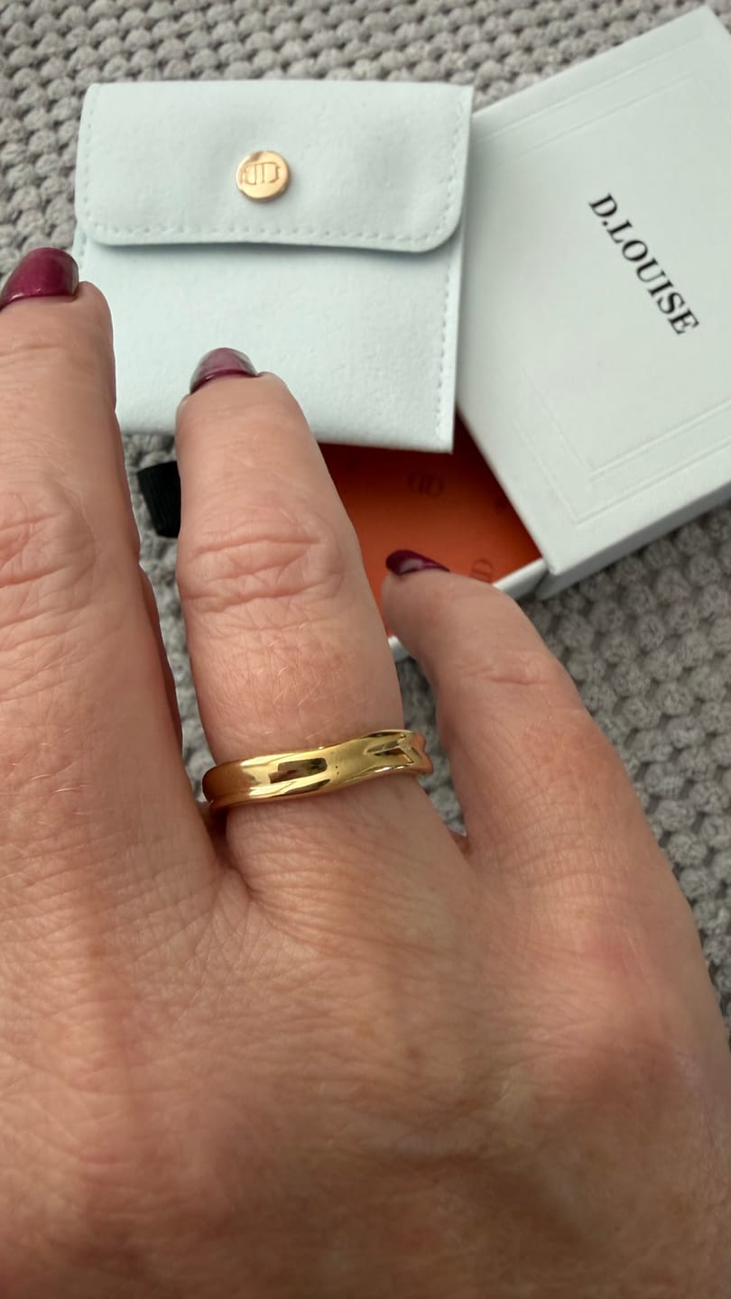 Customer photo review of Molten Slim Ring