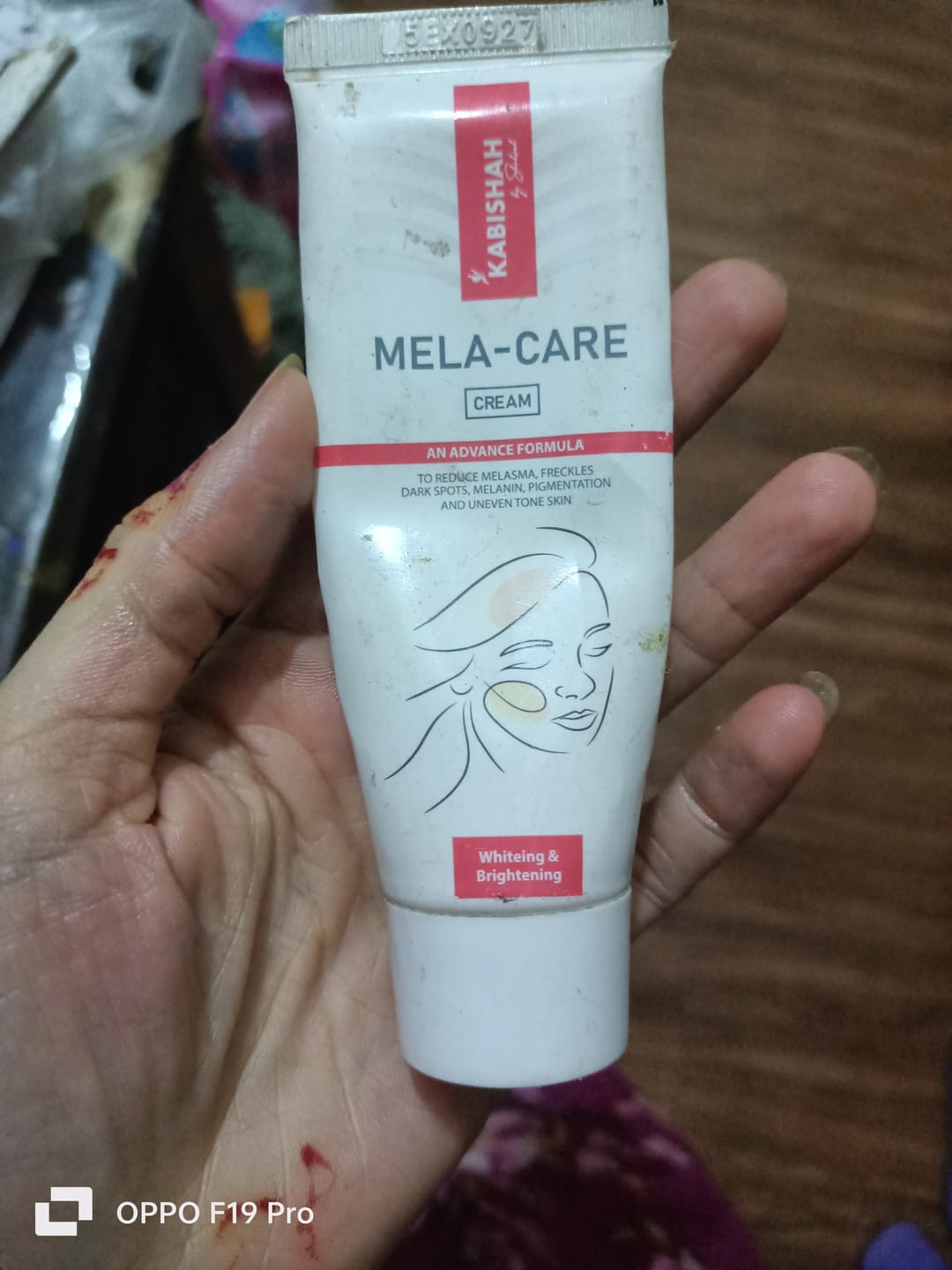 Customer photo review of Mela Care Advanced Brightening Cream