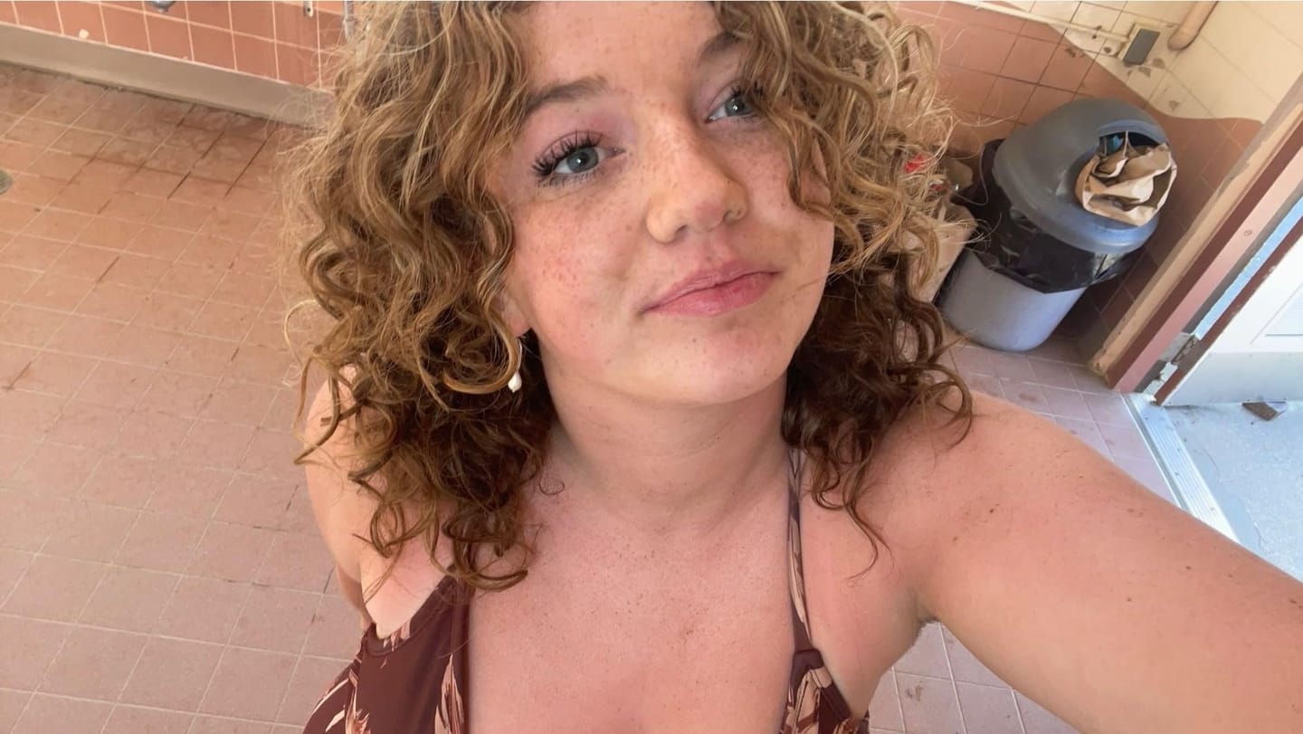 Customer photo review of Transdermal Tanning Patch