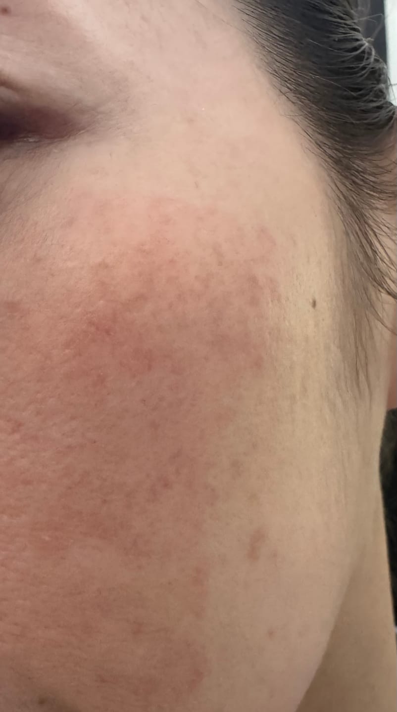 Customer photo review of Timeless Balm Cleanser