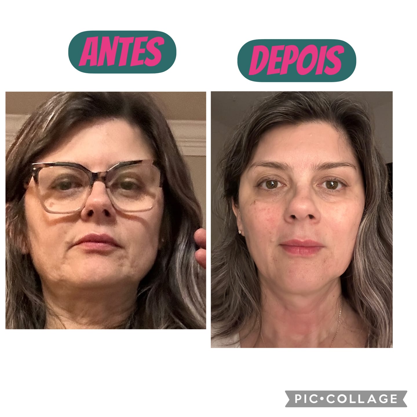 Customer photo review of 6 Month Supply - Deep Collagen Cream