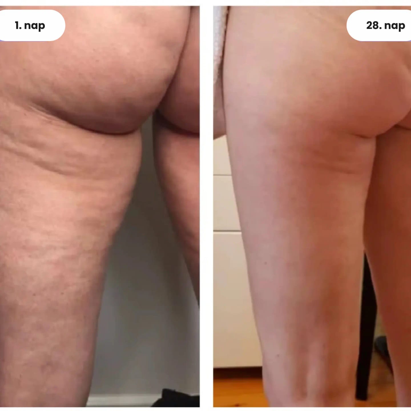 Customer photo review of Nordlys™ 3D Shape Leggings