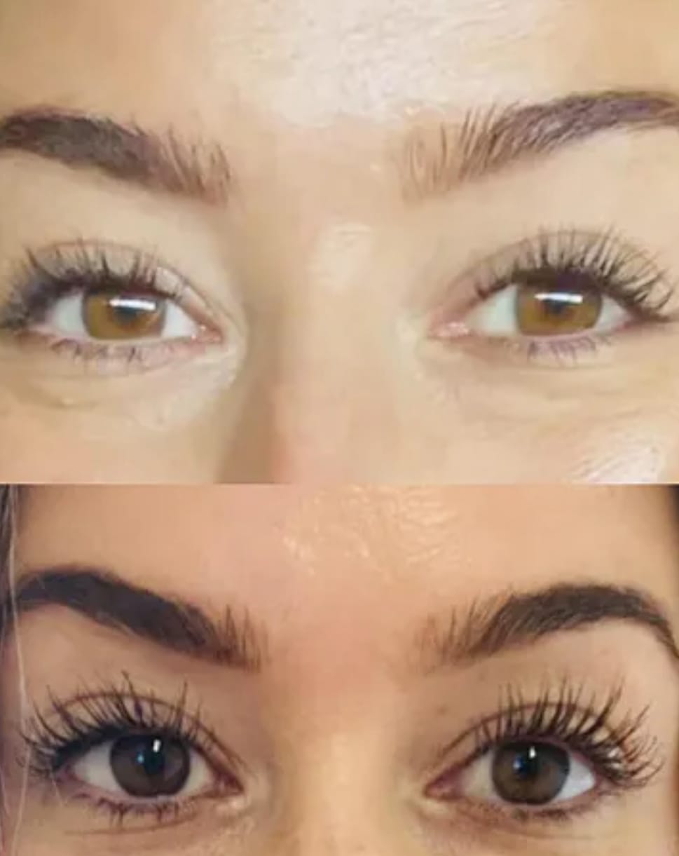 Customer photo review of סרום לשיקום וצמיחת הריסים של NOVELA