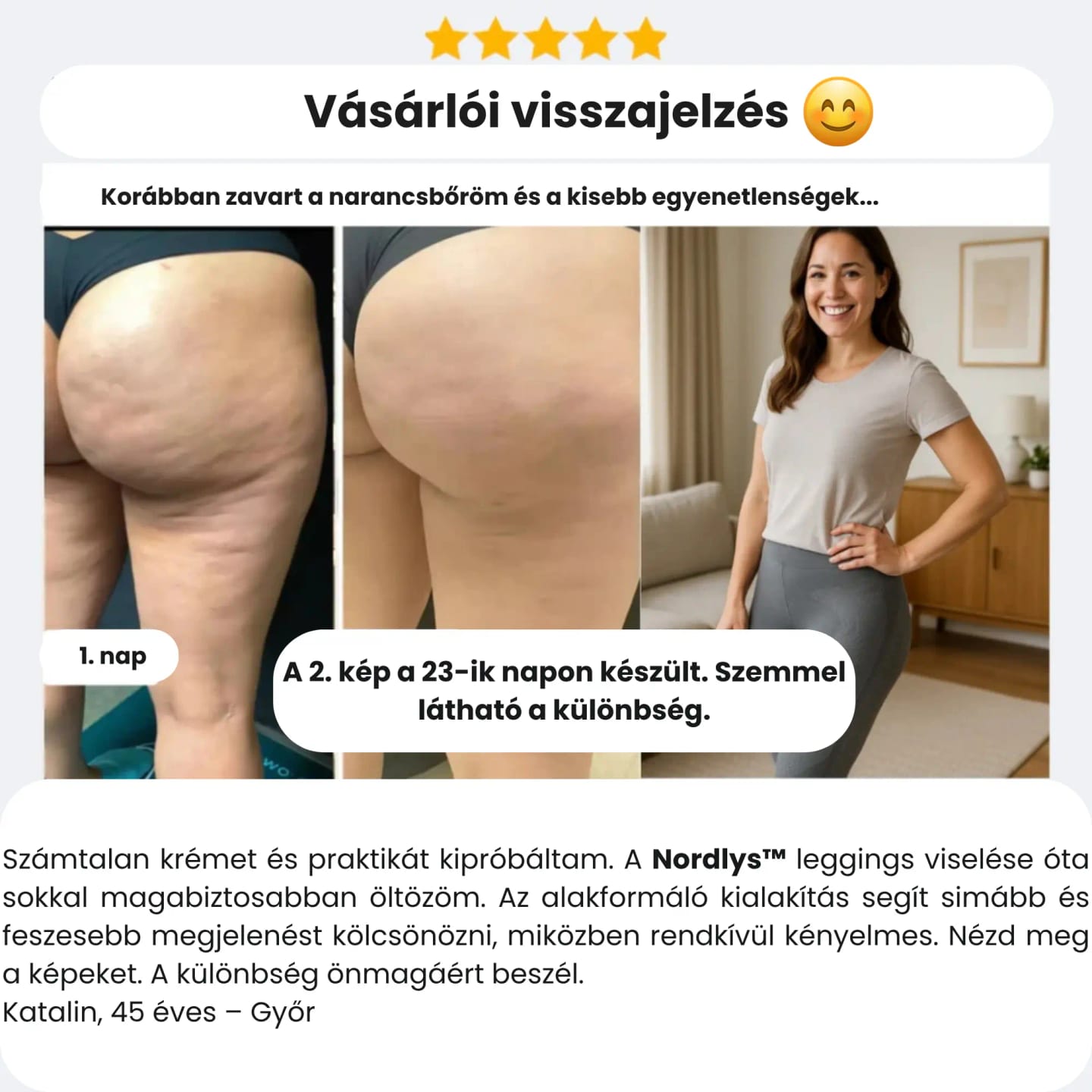 Customer photo review of Nordlys™ 3D Shape Leggings