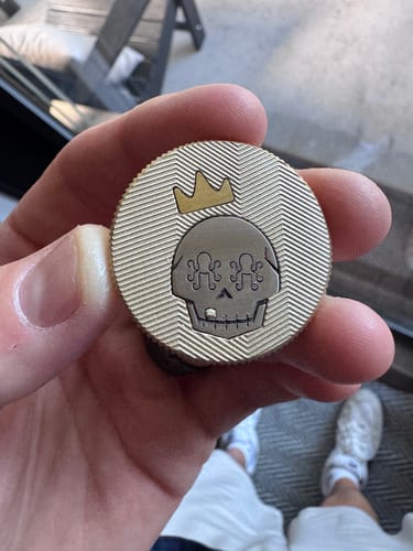 Customer photo review of 💀👑 The Gold Tooth