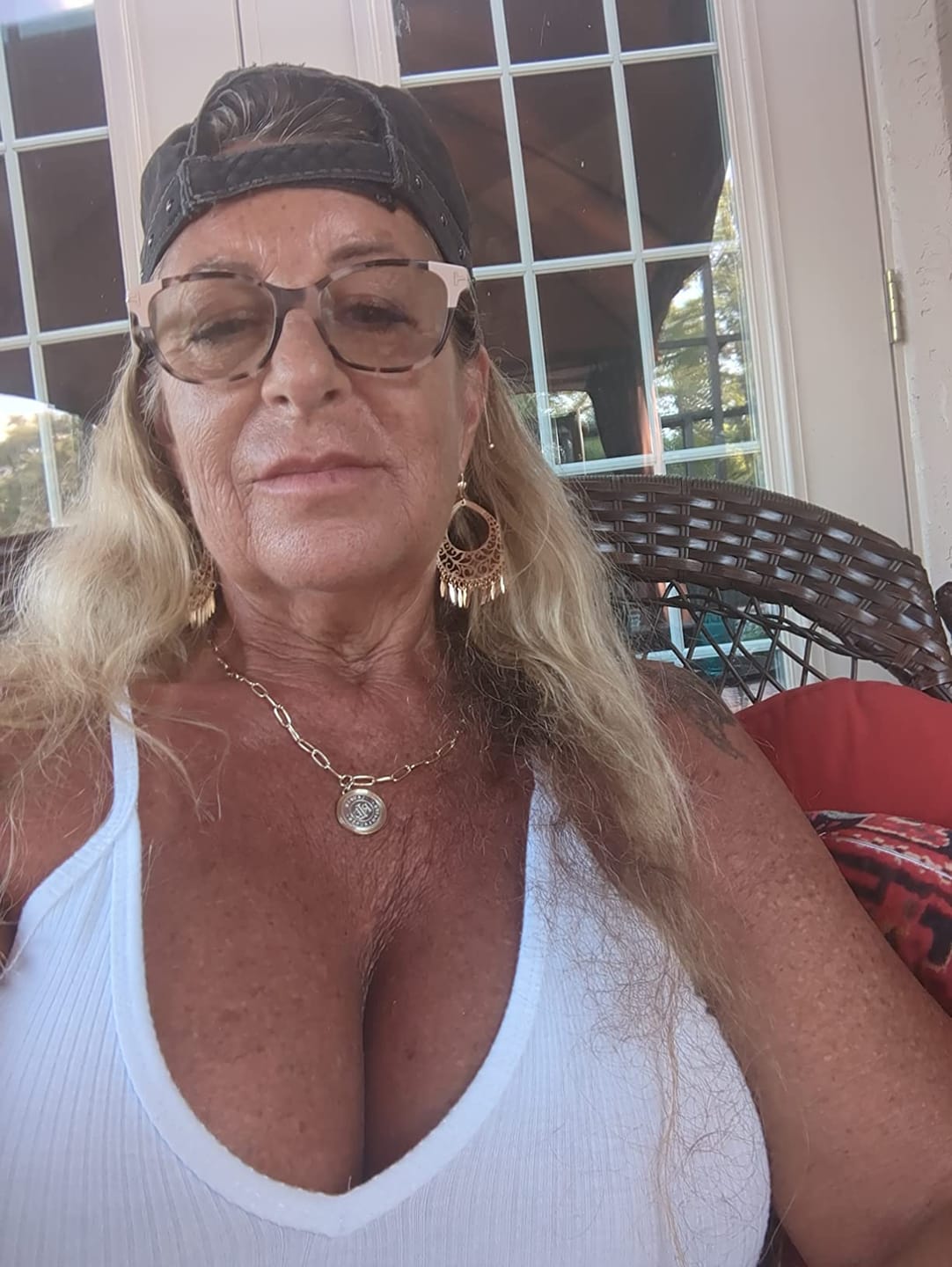 Customer photo review of Transdermal Tanning Patch