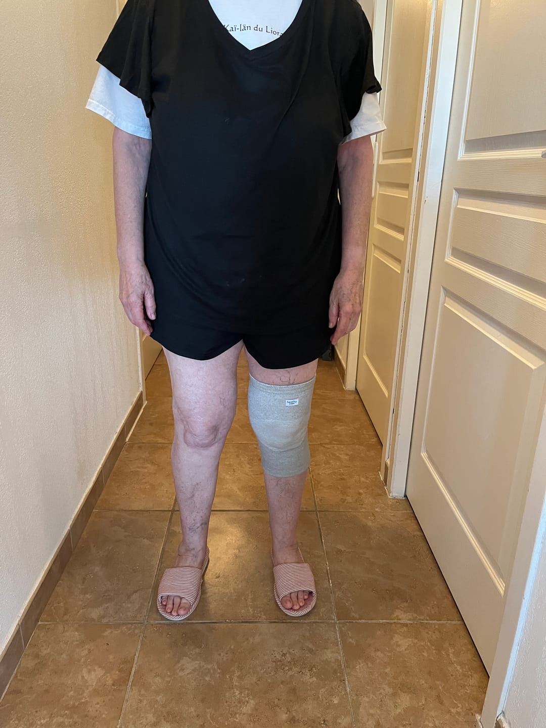 Customer photo review of Genouillère de Compression