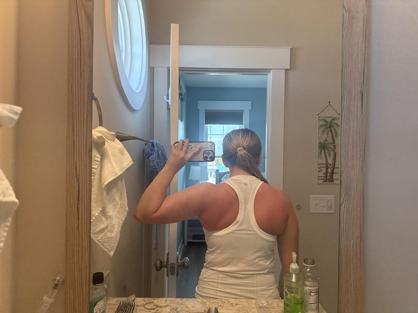 Customer photo review of Transdermal Tanning Patch
